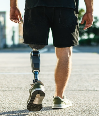 Rotationplasty Revolution
