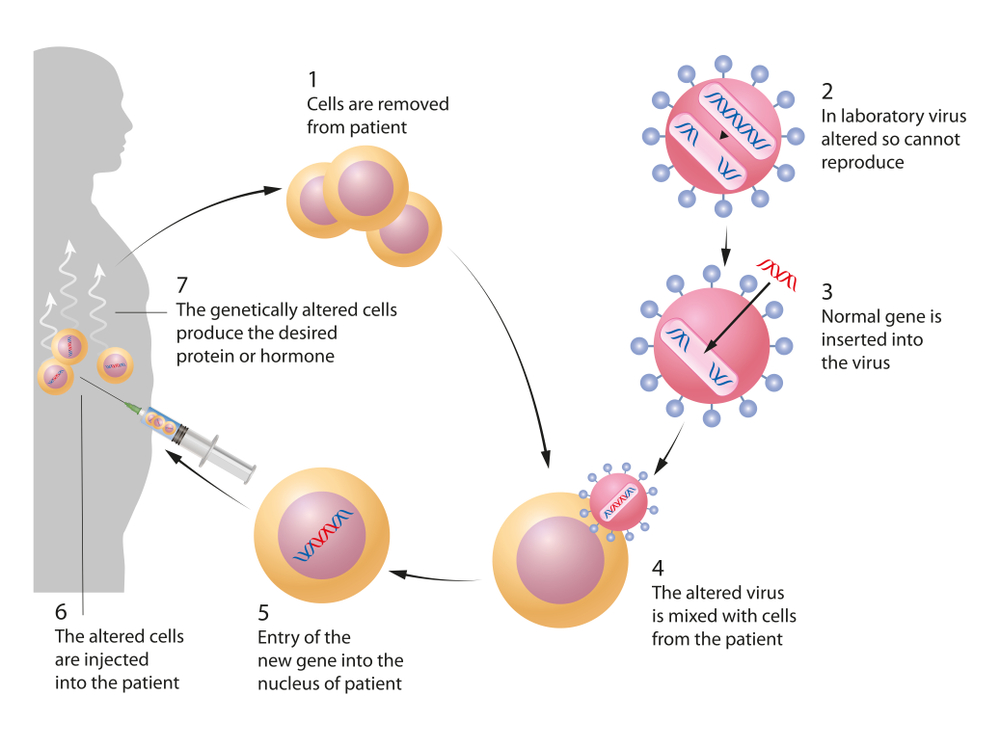 Gene Therapy