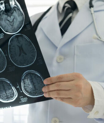 15 Things to Start Doing at 50 That'll Save Your Brain at 80